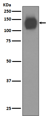 CD31 Rabbit mAb