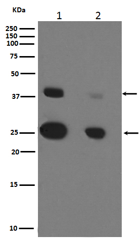 Cathepsin D Rabbit mAb