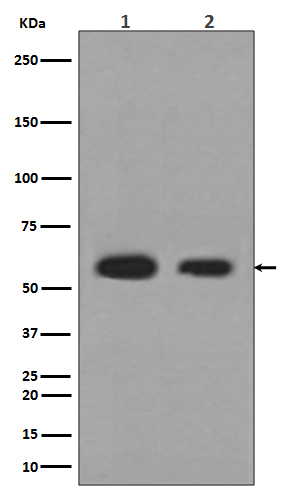 Calreticulin Rabbit mAb