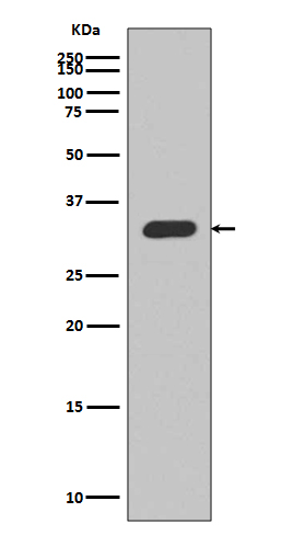 p27 KIP 1 Rabbit mAb