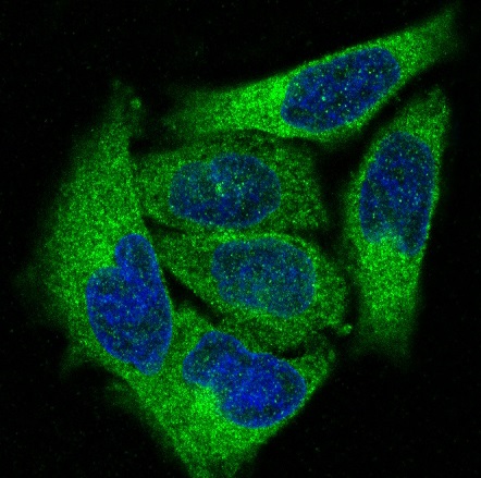 PKC alpha Rabbit mAb