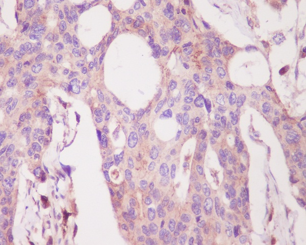 PKC alpha Rabbit mAb