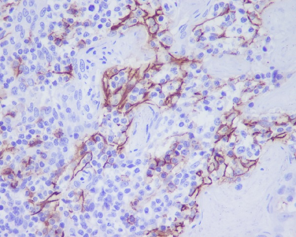CD31 Rabbit mAb 