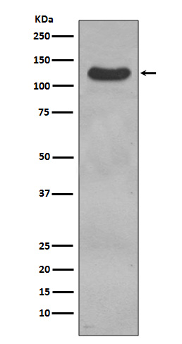 CD31 Rabbit mAb 