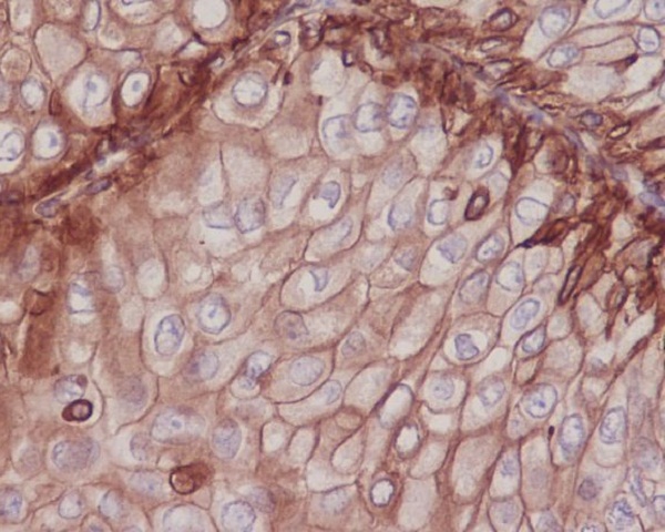 Integrin beta 1 Rabbit mAb
