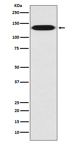 Integrin beta 1 Rabbit mAb