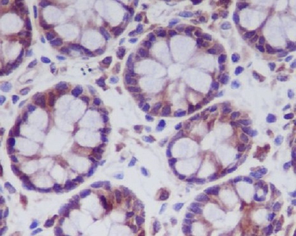 MLKL Rabbit mAb