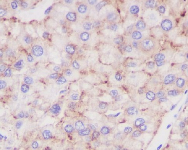 LAMP2 Rabbit mAb