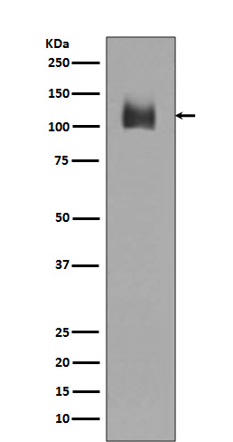 LAMP2 Rabbit mAb