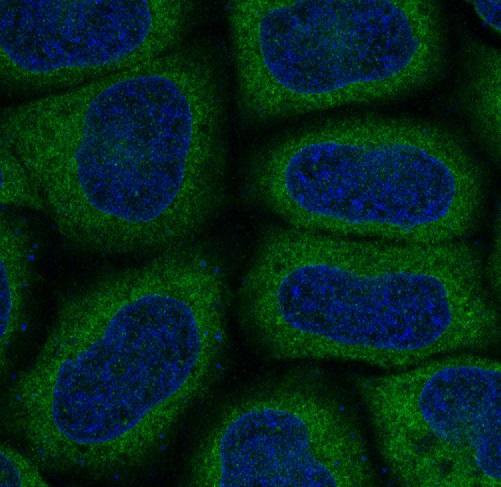 MAP1LC3A Rabbit mAb