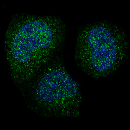 Cyclin B1 Rabbit mAb
