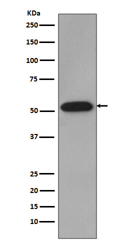 Cyclin B1 Rabbit mAb