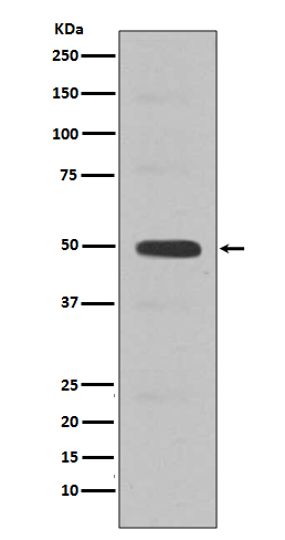 Cyclin E2 Rabbit mAb
