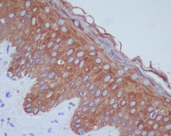 Cytokeratin 14 Rabbit mAb