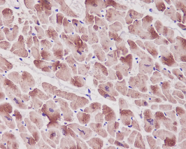 Troponin I Rabbit mAb