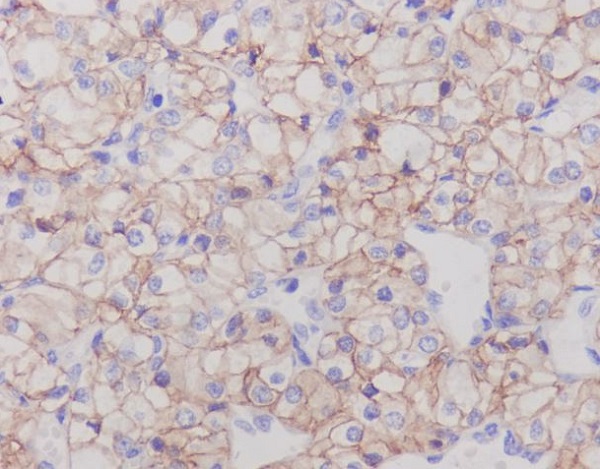 CA9 Rabbit mAb