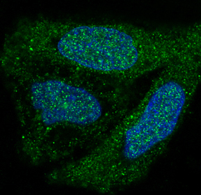 p38 MAPK Rabbit mAb