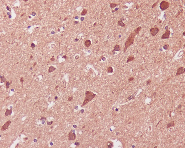 p38 MAPK Rabbit mAb