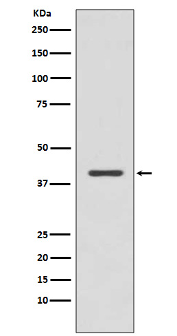 p38 MAPK Rabbit mAb