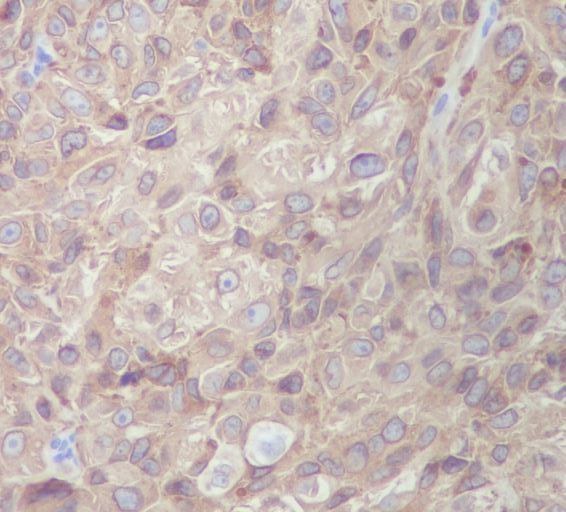 MLANA Rabbit mAb