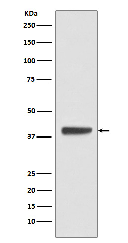 Islet 1 Rabbit mAb