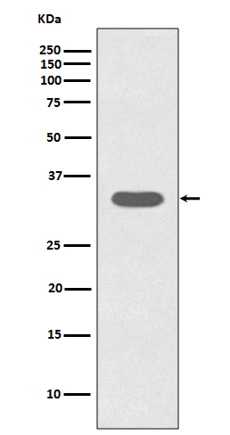 Caspase-6 Rabbit mAb