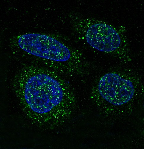 FGFR1 Rabbit mAb