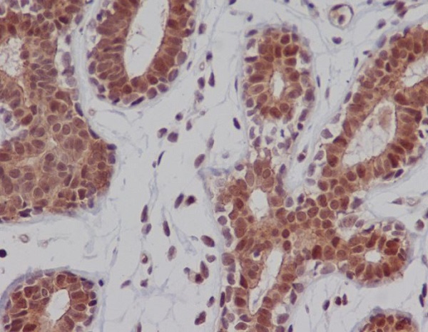 DNA-PKcs Rabbit mAb