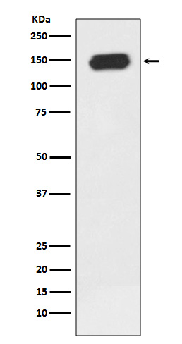 PLC gamma 1 Rabbit mAb