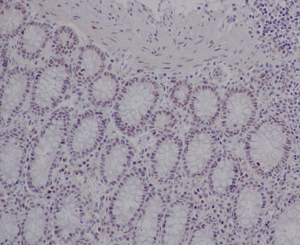 Ku80 Rabbit mAb