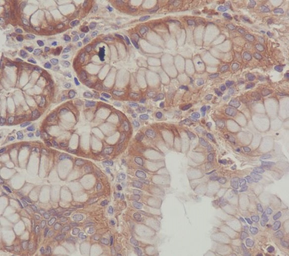 SCF Rabbit mAb