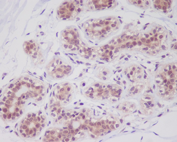 Cortactin Rabbit mAb