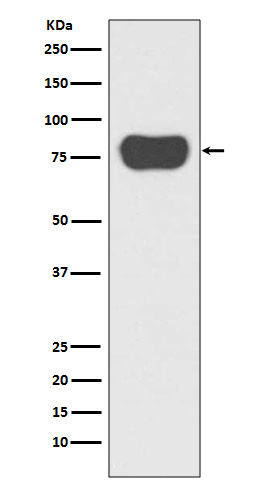 Cortactin Rabbit mAb