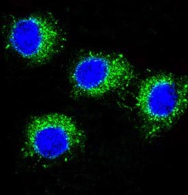 NALP3 Rabbit mAb