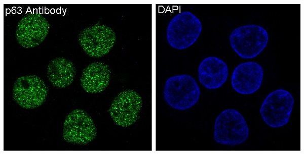 p63 Rabbit mAb