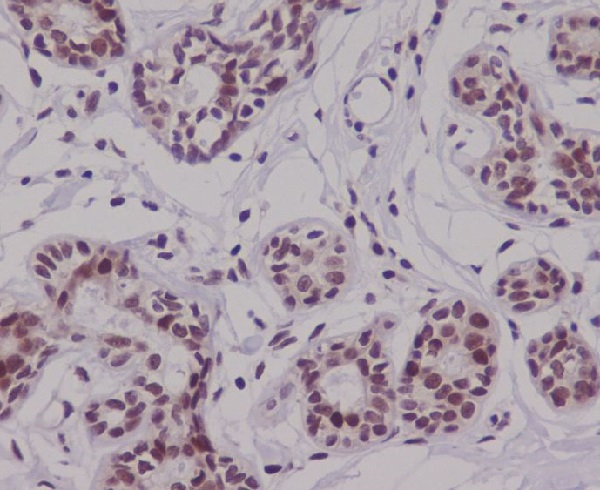 p63 Rabbit mAb