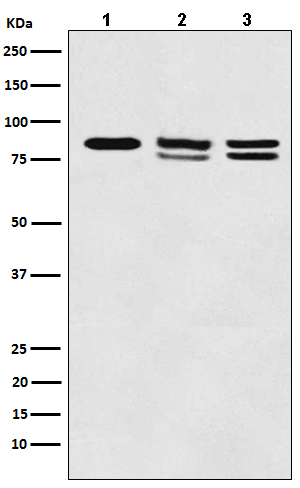 IKK alpha+beta Rabbit mAb