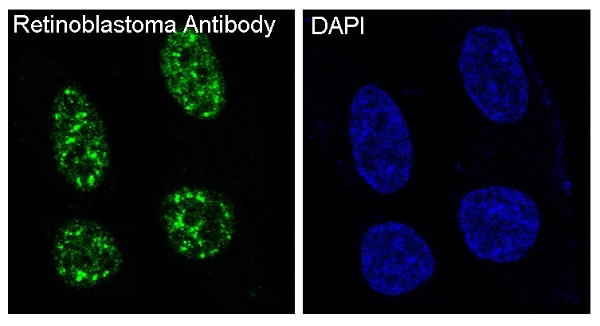 Retinoblastoma Rabbit mAb