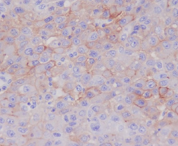 P Glycoprotein Rabbit mAb