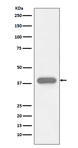 Troponin T Rabbit mAb