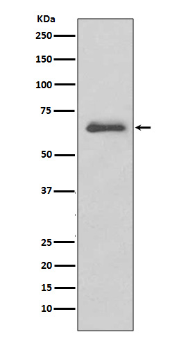 IRAK3 Rabbit mAb