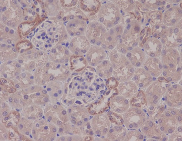 IKK alpha Rabbit mAb