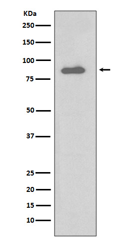 IKK alpha Rabbit mAb