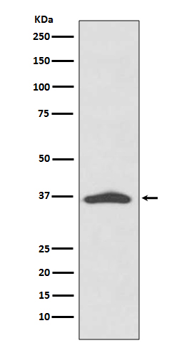 EpCAM Rabbit mAb