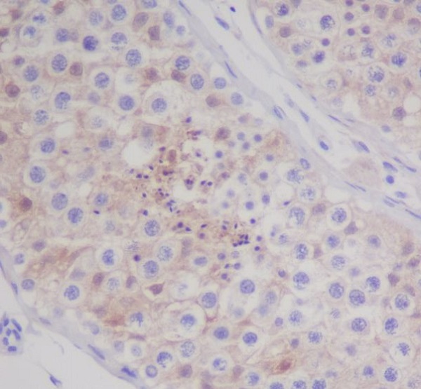 MAP1LC3A Rabbit mAb