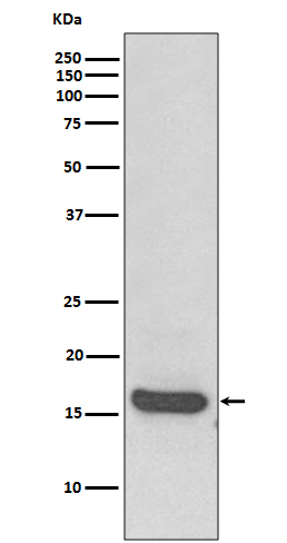 MAP1LC3A Rabbit mAb
