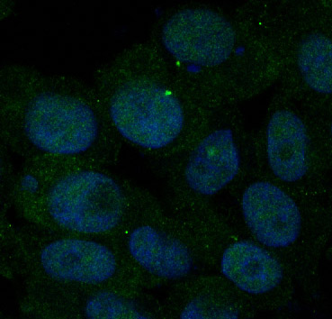 Insulin Receptor Rabbit mAb