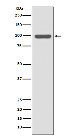 Insulin Receptor Rabbit mAb