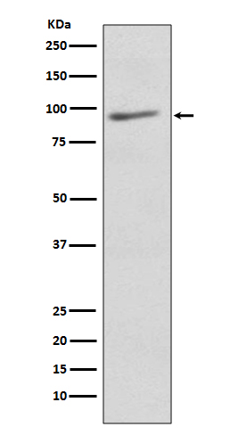 EIF2C3 Rabbit mAb