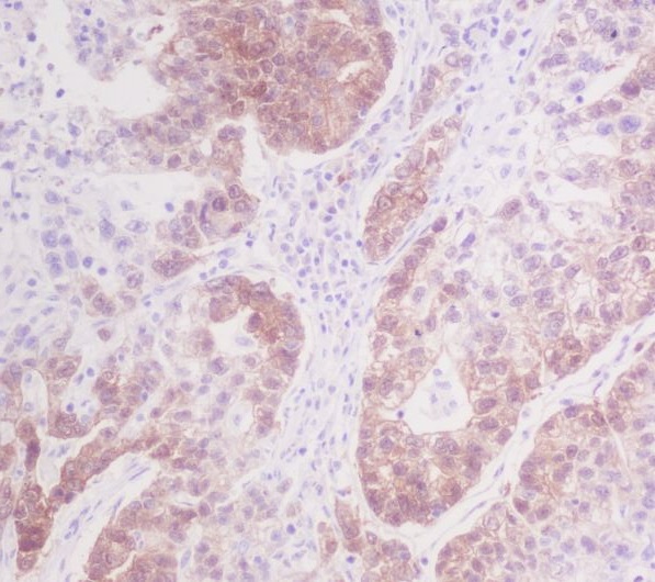 CDK4 Rabbit mAb